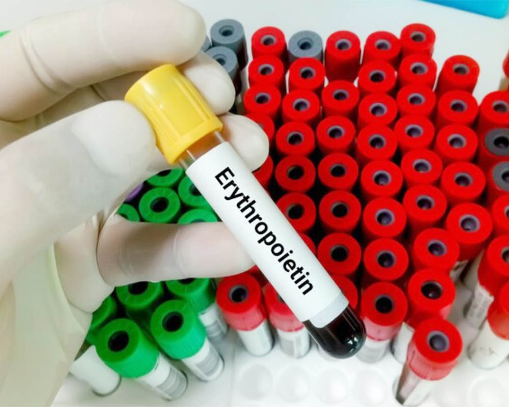 anemia3
