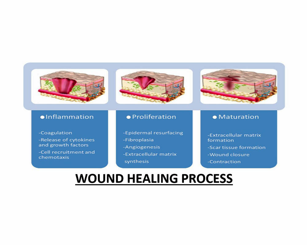wound