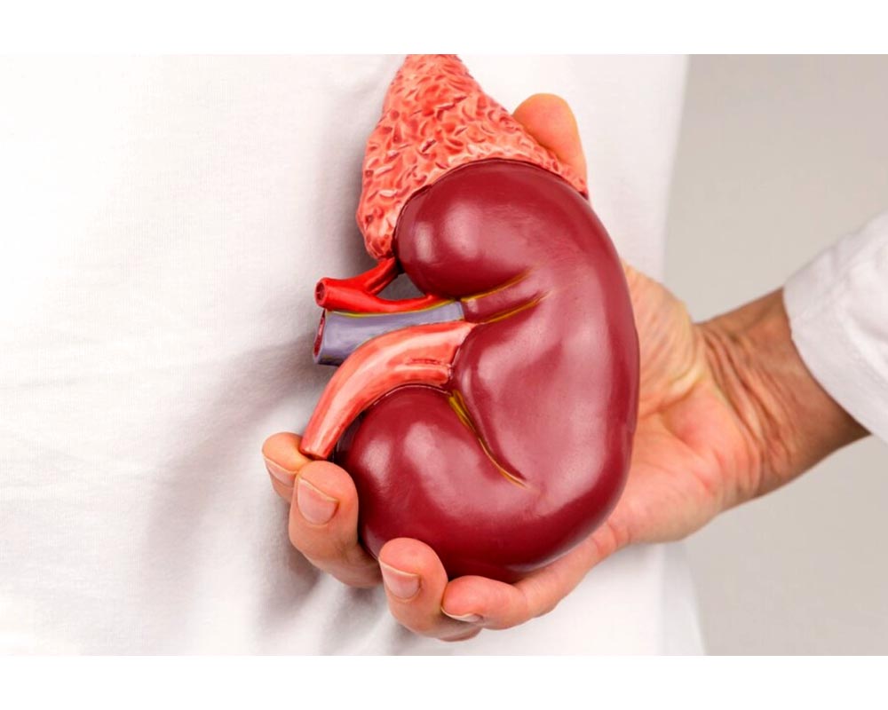 ckd