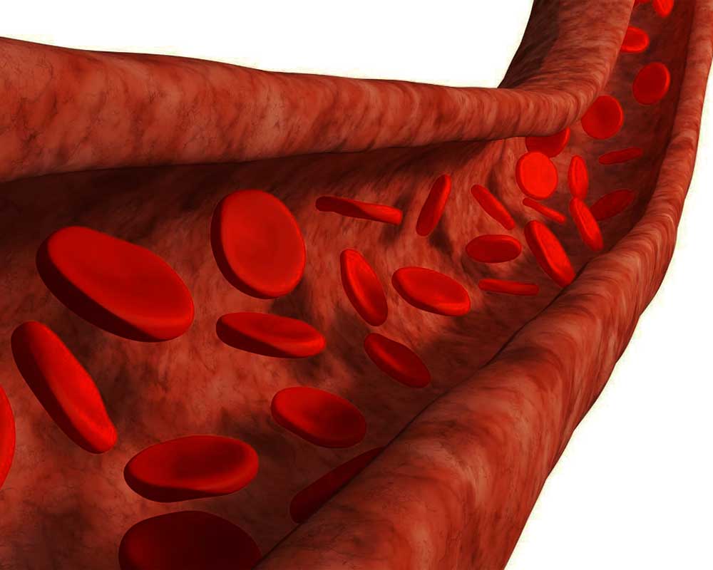 parathyroid1