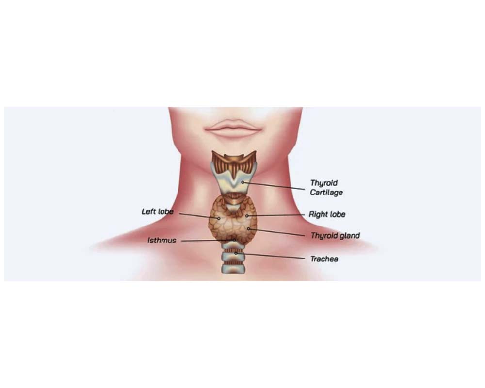 parathyroid4